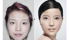 成都医疗整形爆料事件最新,揭秘行业乱象，患者权益如何保障？